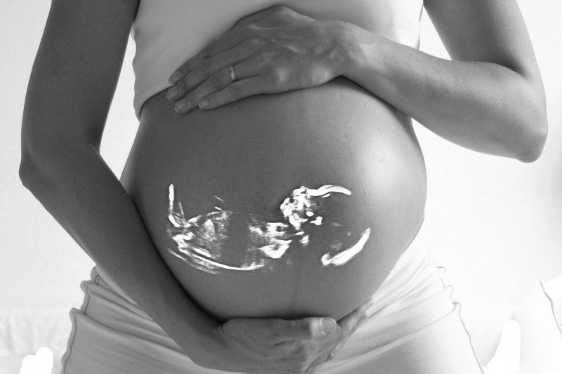 Kenali faktor risiko sebabkan kelahiran bayi prematur Kenali faktor risiko sebabkan kelahiran bayi prematur