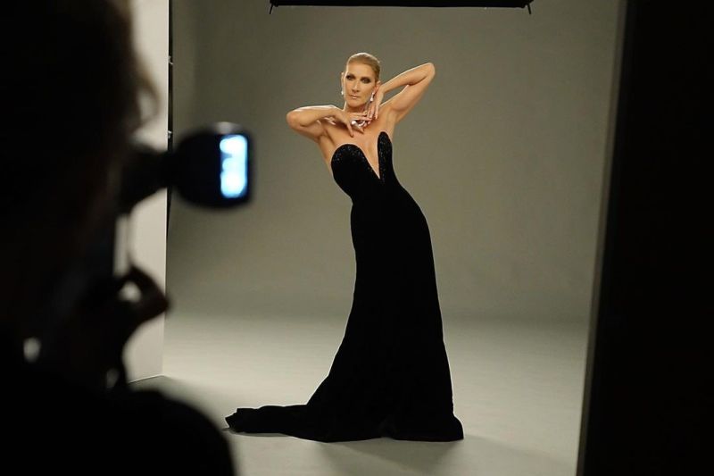 Kelainan neurologis yang dialami Celine Dion