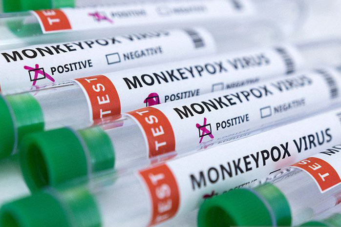 India laporkan kasus pertama cacar monyet