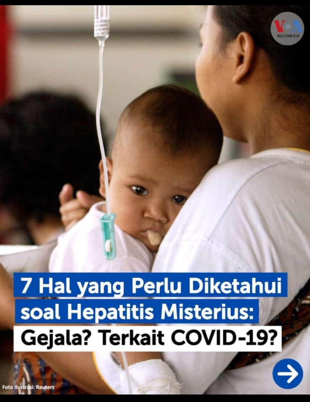 7 hal yang perlu diketahui soal hepatitis misterius 7 hal yang perlu diketahui soal hepatitis misterius