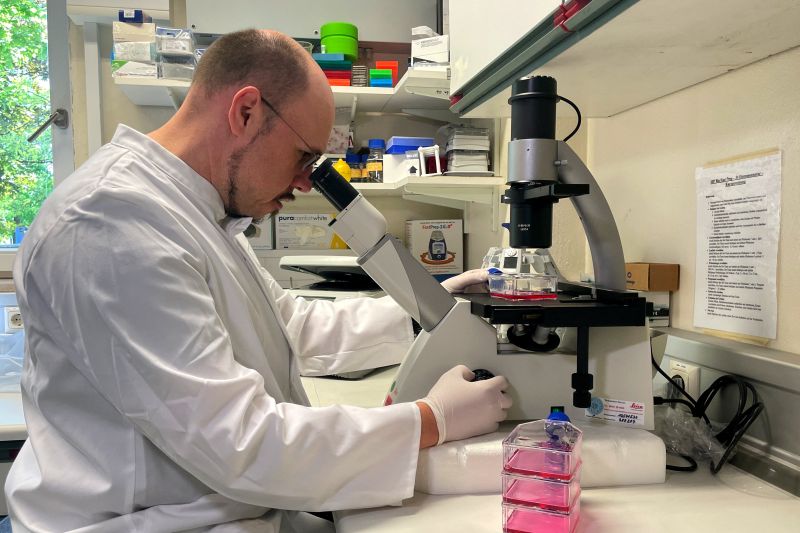 WHO desak negara-negara segera bendung penyebaran cacar monyet WHO desak negara-negara segera bendung penyebaran cacar monyet