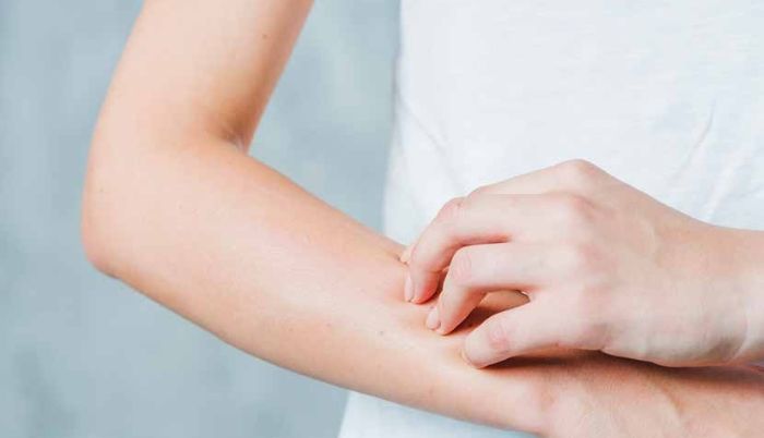 7 cara paling efektif mengatasi rasa gatal di kulit