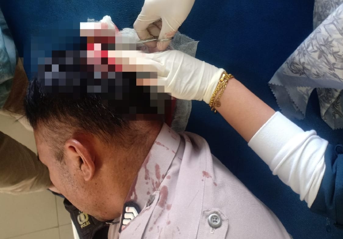 Hendak amankan ODGJ, dua polisi di Bener Meriah luka terkena senjata tajam