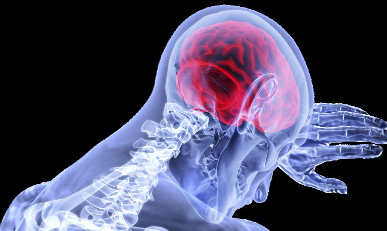 Faktor waktu sangat penting untuk penanganan stroke Faktor waktu sangat penting untuk penanganan stroke