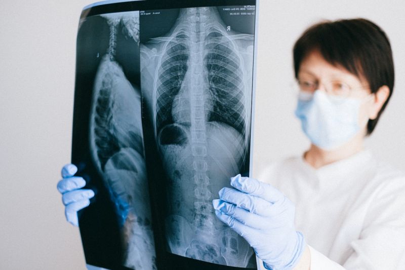 Waspada pneumonia jika frekuensi nafas balita lebih 40 kali per menit Waspada pneumonia jika frekuensi nafas balita lebih 40 kali per menit