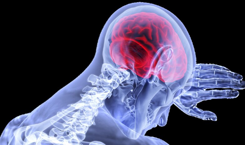 Dokter: Angka kematian stroke bisa turun jika pasien cepat tertangani Dokter: Angka kematian stroke bisa turun jika pasien cepat tertangani