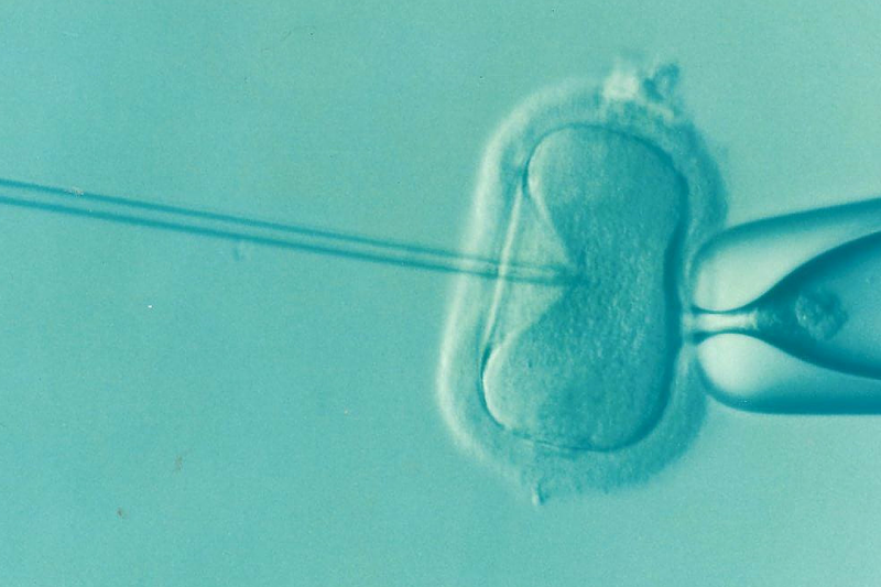 Dokter: perbaiki gaya hidup agar proses bayi tabung optimal