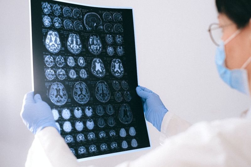 WaspadaI gejala meningitis sakit kepala yang tak kunjung sembuh WaspadaI gejala meningitis sakit kepala yang tak kunjung sembuh