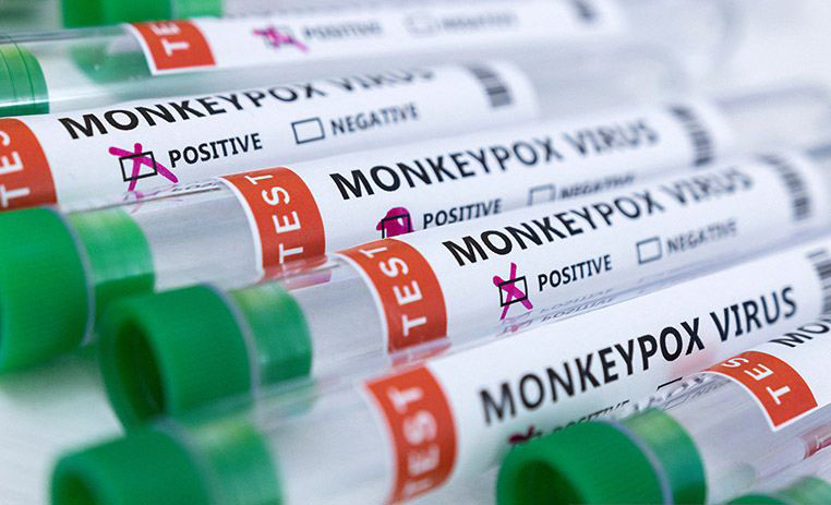 Varian baru cacar monyet ditemukan di Inggris