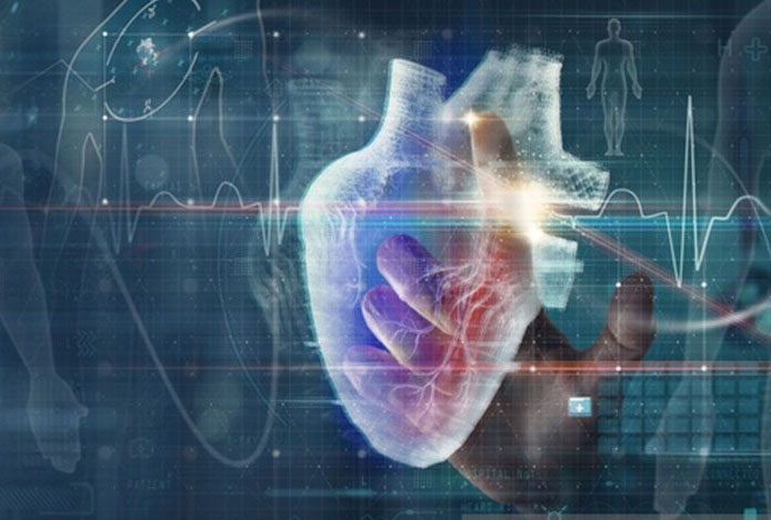 Pentingnya IVUS dan OCT untuk akurasi pemasangan stent jantung