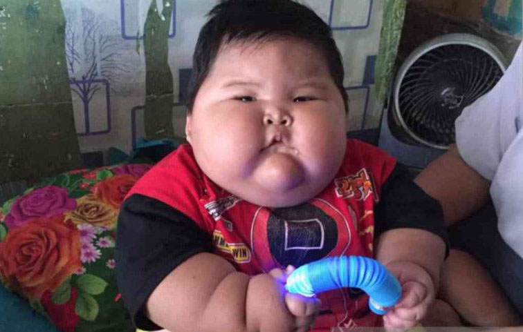 Menkes siap dampingi balita obesitas di Bekasi dengan perawatan Menkes siap dampingi balita obesitas di Bekasi dengan perawatan