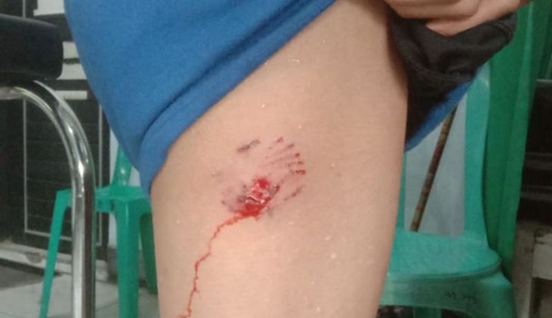 Seorang anak di NTT meninggal usai digigit anjing rabies