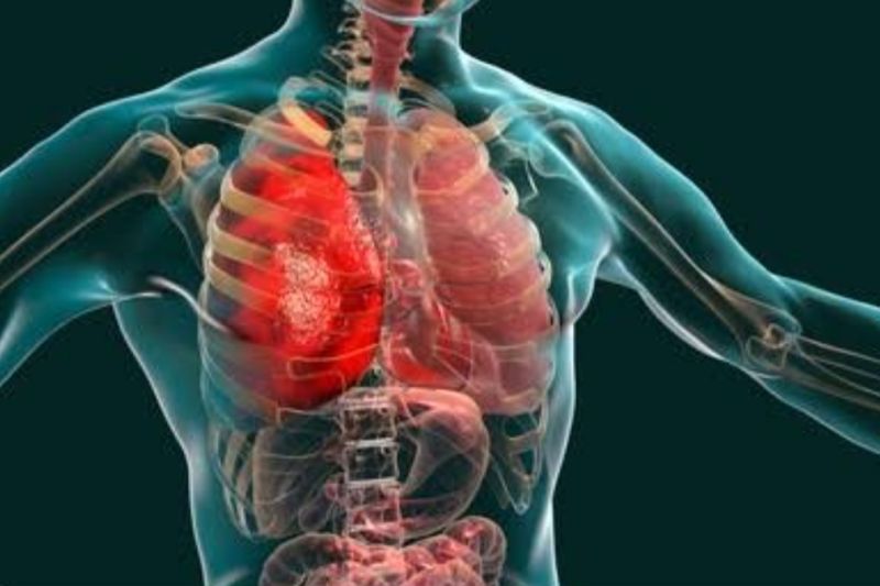 Kemenkes imbau masyarakat tidak panik sikapi wabah pneumonia di China
