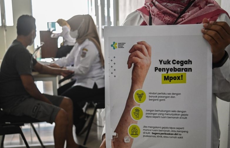 Dinkes DKI pastikan fasilitas kesehatan siap tangani cacar monyet