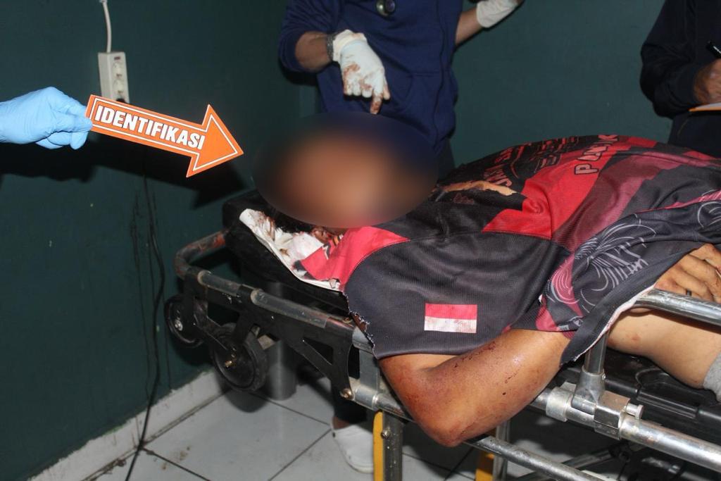 Seorang warga sipil di Mulia Papua ditembak OTK di depan kiosnya Seorang warga sipil di Mulia Papua ditembak OTK di depan kiosnya