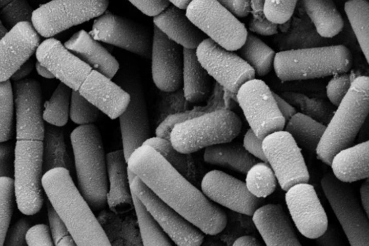 Bakteri Bacillus Cereus picu keracunan cireng di Bandung Barat