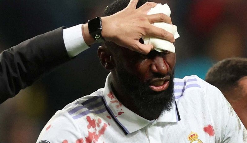 Ancelotti konfirmasi Rudiger alami ketidaknyamanan otot Ancelotti konfirmasi Rudiger alami ketidaknyamanan otot