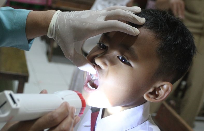 Pentingnya perawatan gigi pada bayi Pentingnya perawatan gigi pada bayi