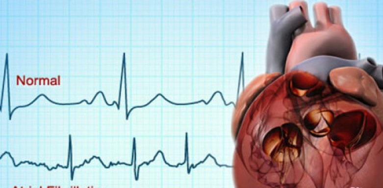 Dokter: Skrining untuk deteksi risiko kelainan jantung saat olahraga Dokter: Skrining untuk deteksi risiko kelainan jantung saat olahraga