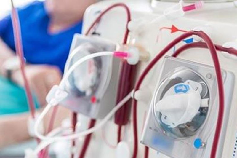 Dokter RSCM sebut banyaknya pasien dialisis anak-anak karena rujukan Dokter RSCM sebut banyaknya pasien dialisis anak-anak karena rujukan