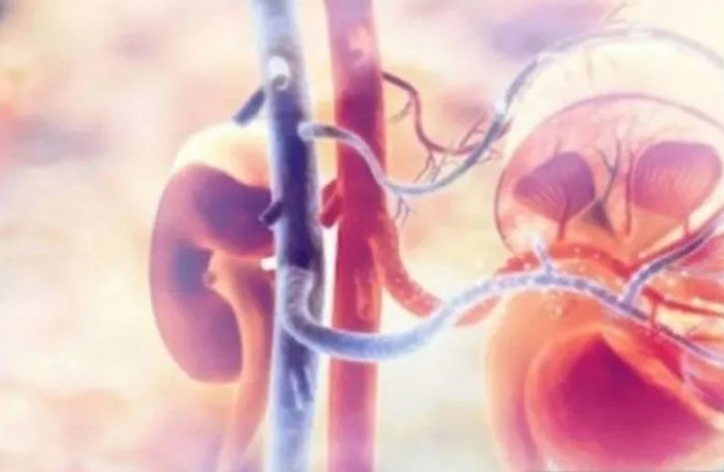 Rekomendasi pola makan yang baik untuk menjaga kesehatan ginjal Rekomendasi pola makan yang baik untuk menjaga kesehatan ginjal