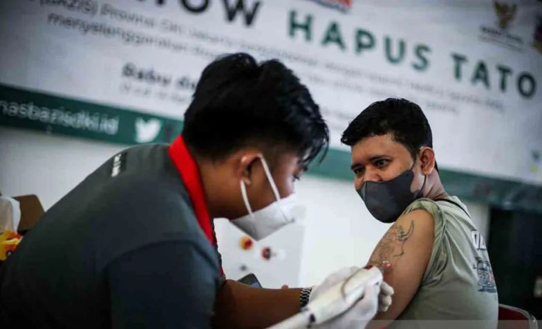 Legislator ingatkan DKI awasi aspek higienis alat hapus tato gratis