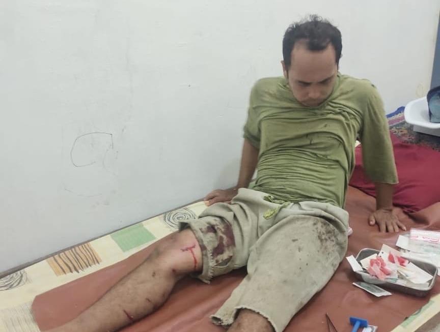 Seorang warga Langkat kembali diterkam harimau