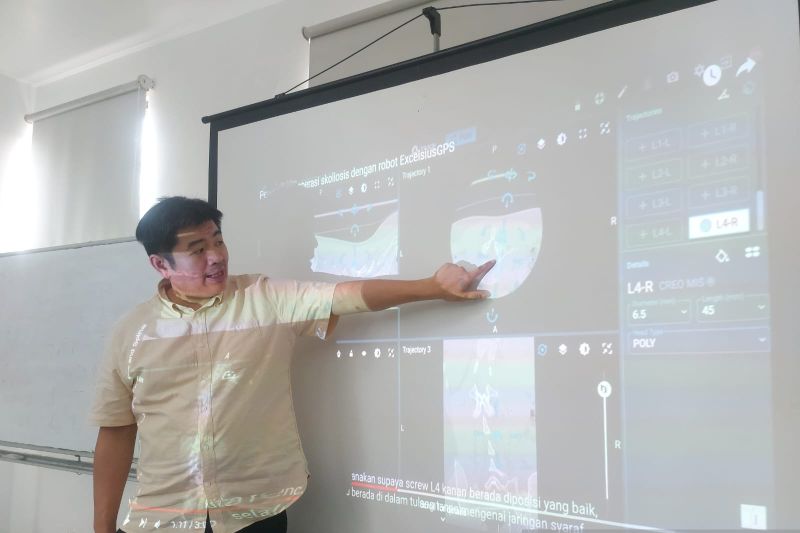Kelainan tulang belakang bentuk huruf S sering ditemukan usia remaja Kelainan tulang belakang bentuk huruf S sering ditemukan usia remaja