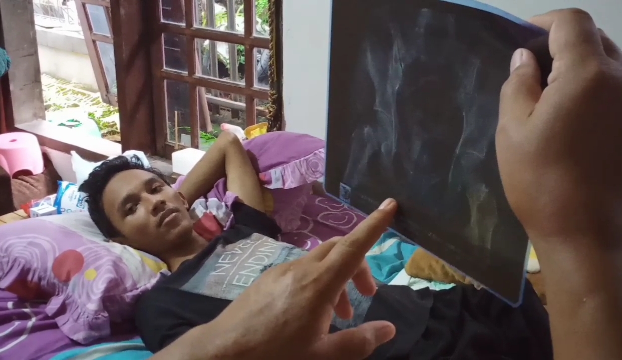 Pemuda terlindas truk akibat motor dihentikan tiba-tiba oleh polisi masih jalani perawatan Pemuda terlindas truk akibat motor dihentikan tiba-tiba oleh polisi masih jalani perawatan