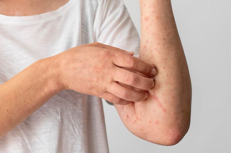 Deteksi lupus si seribu wajah bukan diagnosis mandiri Deteksi lupus si seribu wajah bukan diagnosis mandiri
