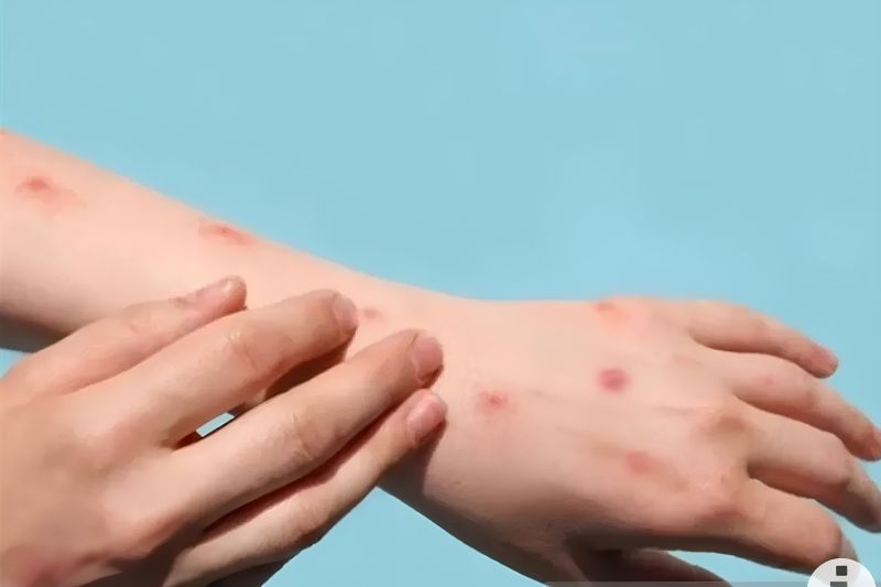 IDAI minta Kemenkes masifkan sosialisasi jadwal vaksin MMR-Varicella IDAI minta Kemenkes masifkan sosialisasi jadwal vaksin MMR-Varicella