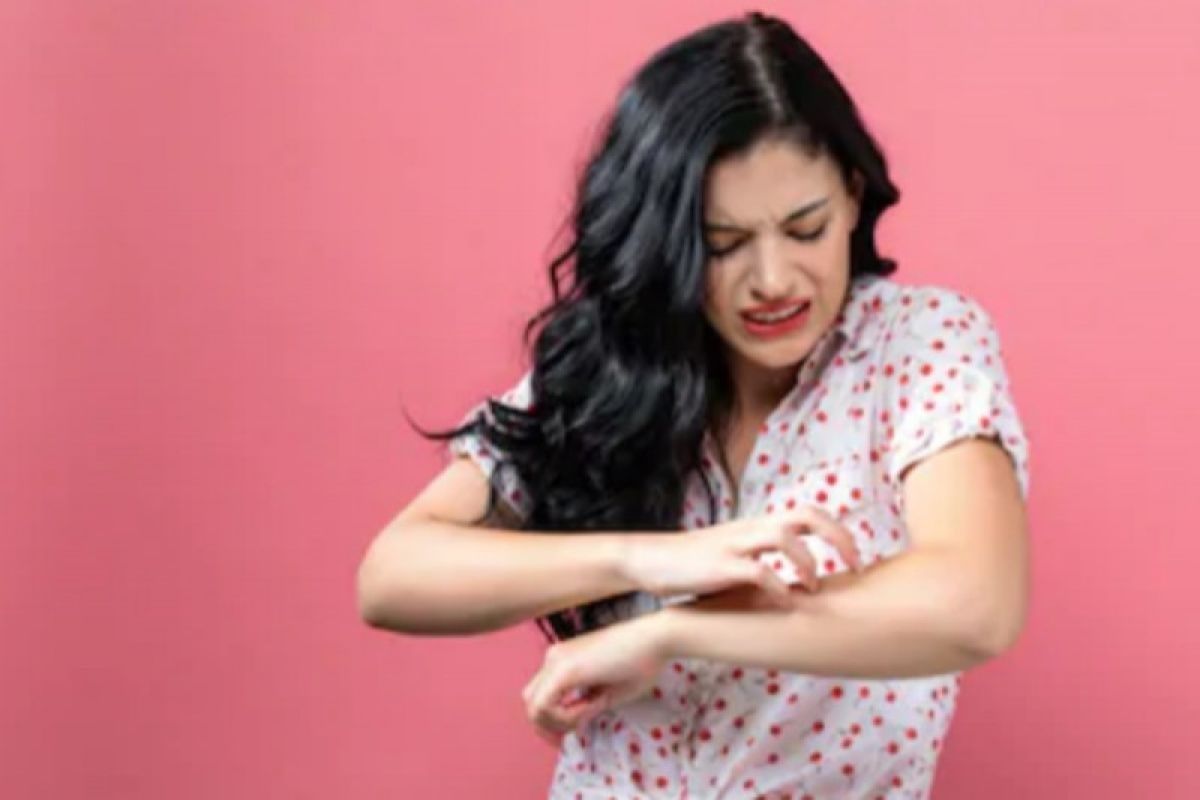 Penyebab biduran dan cara mengatasinya dengan tepat Penyebab biduran dan cara mengatasinya dengan tepat