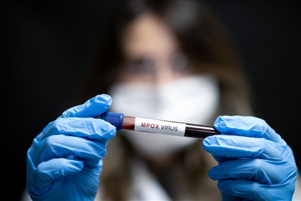CDC: Korban jiwa akibat mpox sejak awal 2024 melampaui angka 1.100 CDC: Korban jiwa akibat mpox sejak awal 2024 melampaui angka 1.100