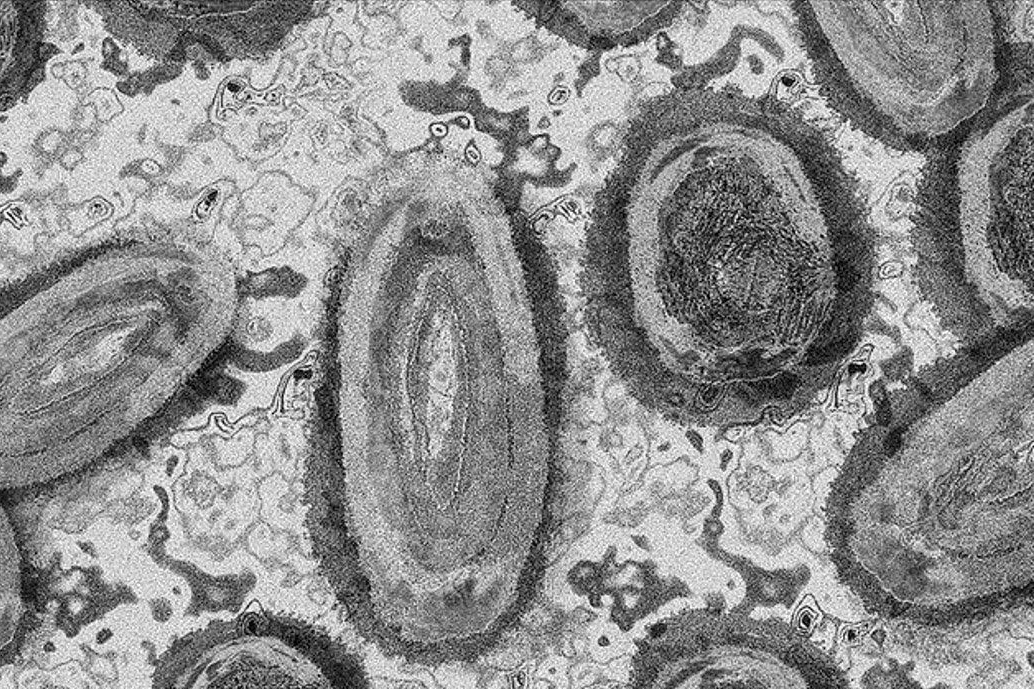 WHO setujui uji diagnostik mpox pertama untuk penggunaan darurat WHO setujui uji diagnostik mpox pertama untuk penggunaan darurat