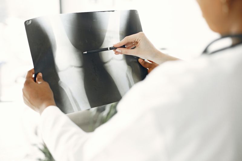 Dokter : Osteoporosis perlu dicegah sejak dini Dokter : Osteoporosis perlu dicegah sejak dini