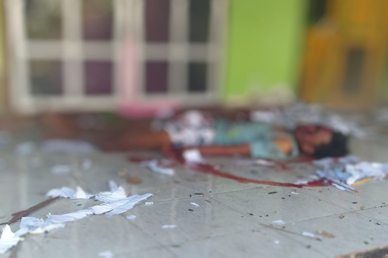 Dua warga Lombok Tengah-NTB luka parah akibat ledakan petasan 8 kg Dua warga Lombok Tengah-NTB luka parah akibat ledakan petasan 8 kg