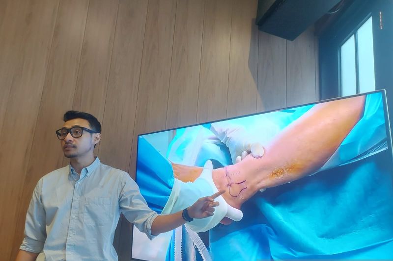 Dokter: Pemilihan sepatu jadi faktor utama mencegah cidera kaki Dokter: Pemilihan sepatu jadi faktor utama mencegah cidera kaki