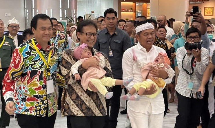 RSHS Bandung pisahkan bayi kembar siam asal Tasikmalaya