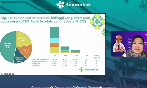 Kemenkes sebut 52,67 persen peserta CKG sekolah alami gigi berlubang Kemenkes sebut 52,67 persen peserta CKG sekolah alami gigi berlubang