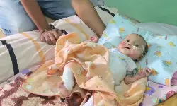 Wali Kota Magelang beri bantuan balita penderita autoimun kulit Wali Kota Magelang beri bantuan balita penderita autoimun kulit