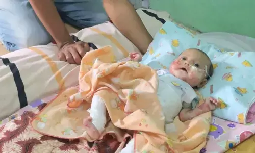 Wali Kota Magelang beri bantuan balita penderita autoimun kulit