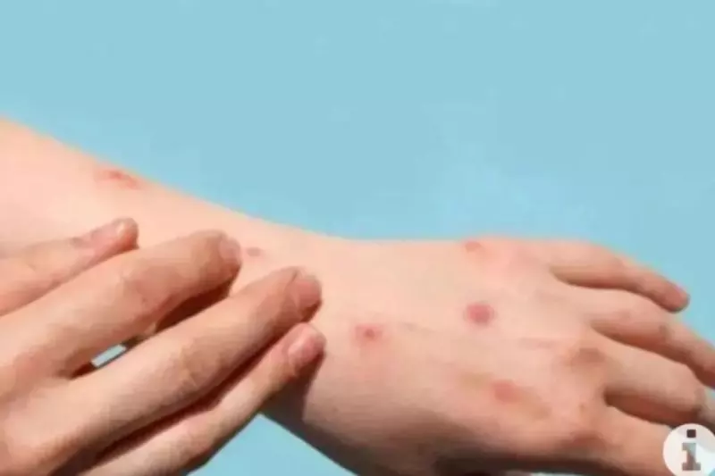 Kemenkes: Tahun ini tak ada kasus Mpox di Indonesia Kemenkes: Tahun ini tak ada kasus Mpox di Indonesia