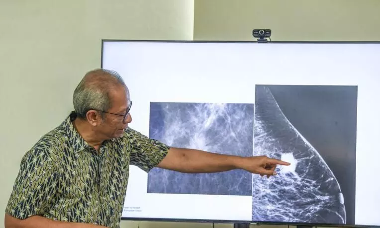 Dokter: Benjolan tidak hilang usai menstruasi ciri kanker payudara