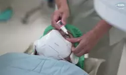 Teknologi SiLK meluncur, alternatif LASIK tanpa flap dengan presisi sub-mikron