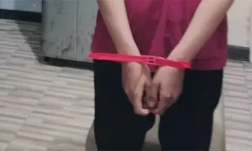 Berebut HP, suami aniaya istri hingga luka di mata dan terancam buta