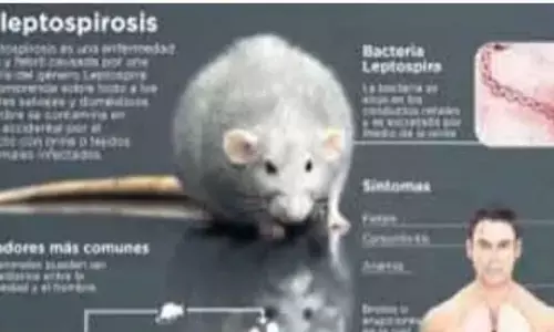 Dokter: Demam tinggi mendadak dan menggigil gejala Leptospirosis