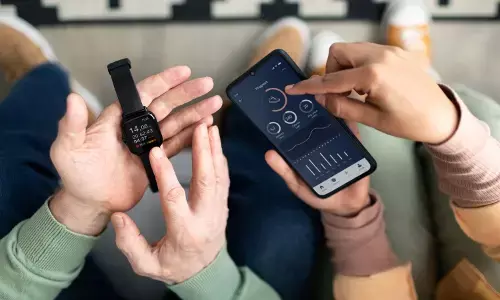 Tips pakai Smartwatch pantau kondisi tubuh saat Puasa