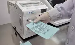 Deteksi dini gangguan lambung dan saluran pencernaan dengan Urea Breath Test dan Endoskopi