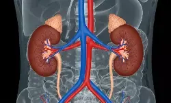 Manfaat puasa Ramadan untuk kesehatan ginjal Manfaat puasa Ramadan untuk kesehatan ginjal